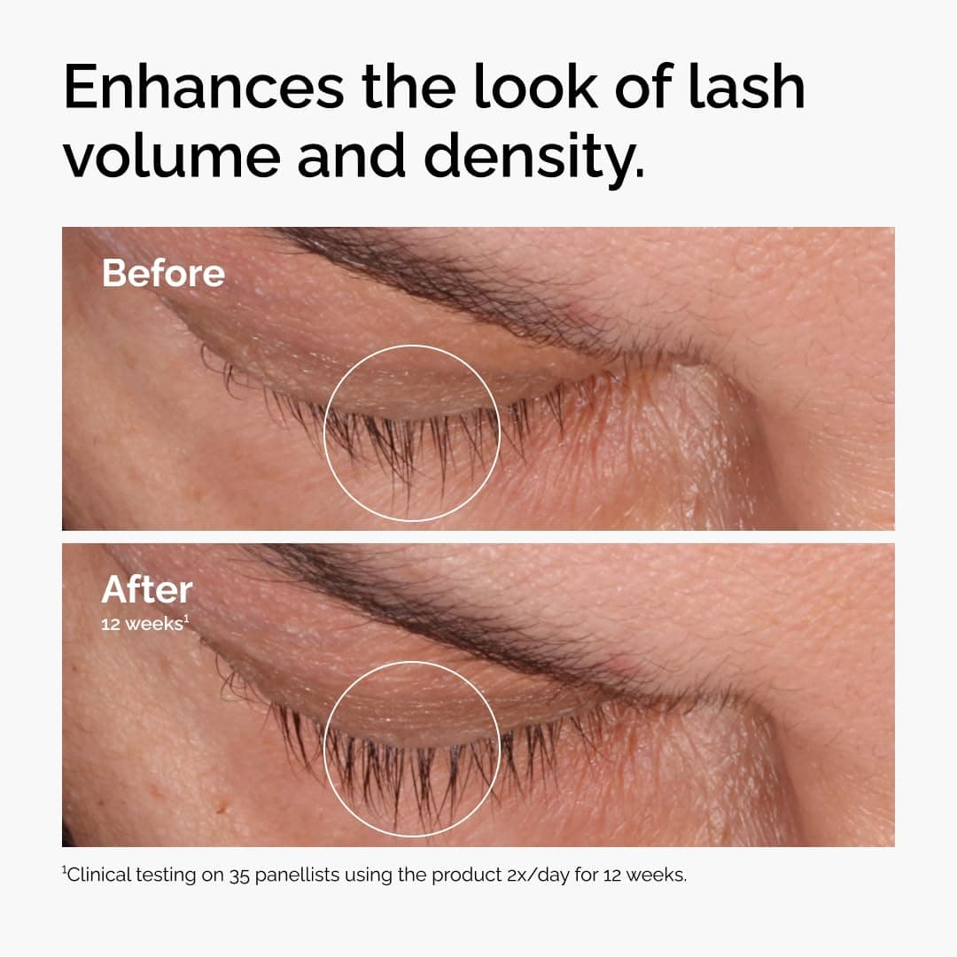 The Ordinary Multi-Peptide Lash and Brow Serum, Peptide-Powered Formula for Thicker, Fuller Looking Lashes & Brows, 5ml thumbnail 2