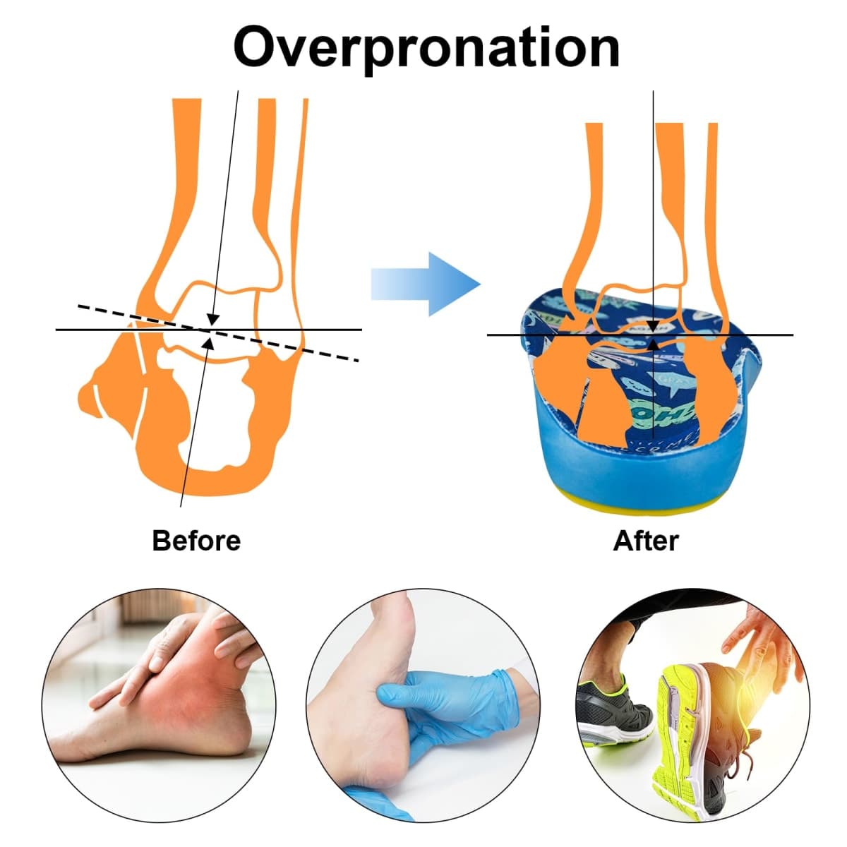 WALKROFEET Children's Overpronation Insoles, Soft PU Foam Orthotic Relieve Plantar Fasciitis, Kids Gel Flat Foot Insoles, Heel Pad(Multicolor) thumbnail 4