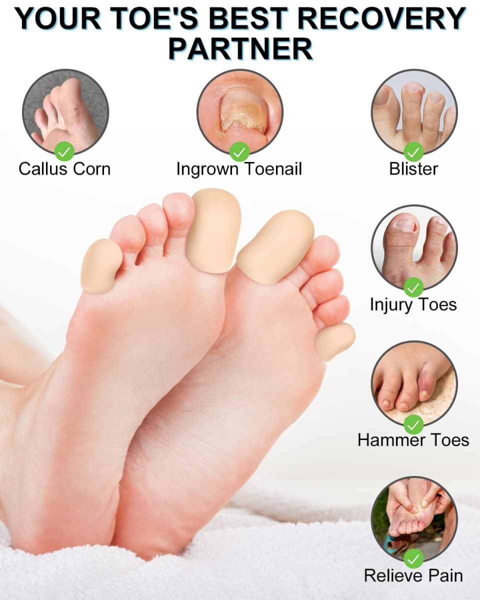 DLMDLM 6 Pcs Gel Toe Cap Small Pinky Toe Protectors, Silicone Toe Covers Corn Pads for Women and Men Feet, Provides Relief from Missing or Ingrown Toenails, Hammer Toes, Blisters (Beige, Small) thumbnail 3