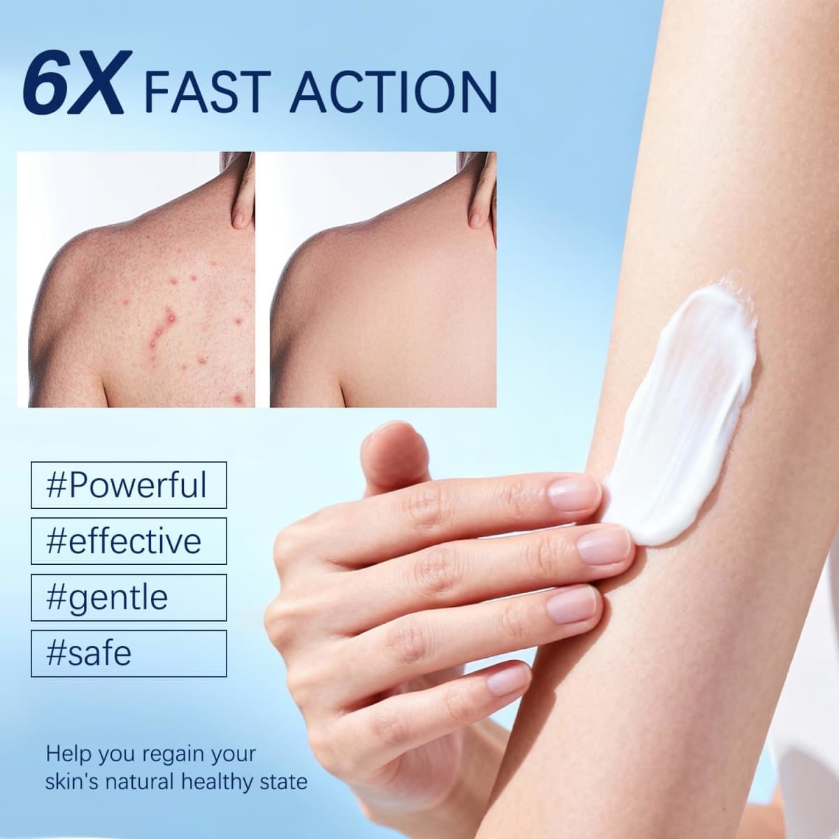 OUHENGTEK Folliculitis Cream | Soothes & Helps Clear Bumps on Scalp, Face, Body & Butt | for Ingrown Hairs, Razor Bumps & Acne | 120g (01) thumbnail 4