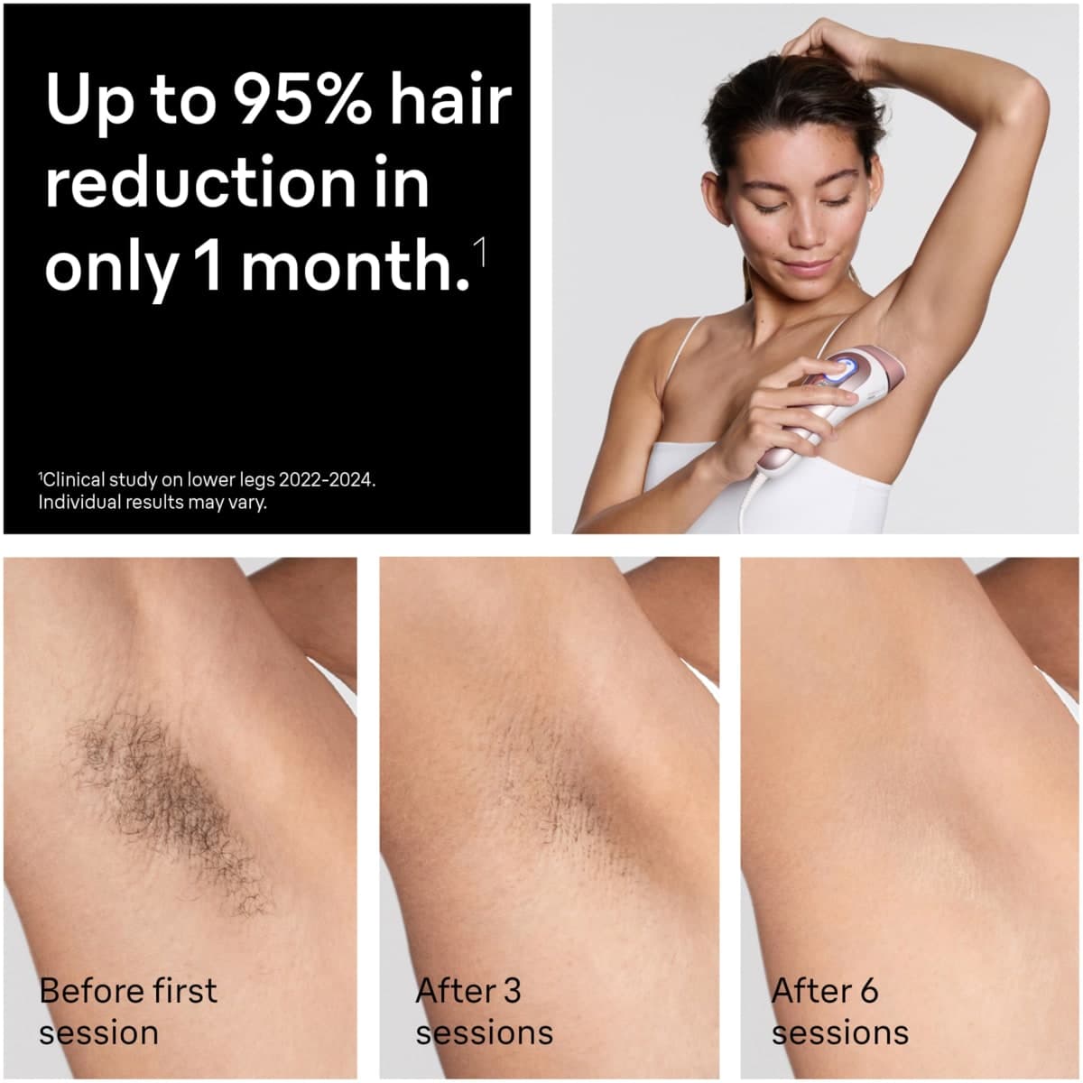 Braun Skin i-Expert Smart IPL PL7219 at Home Laser Hair Removal for Women and Men with App, Premium Pouch, Venus Razor, 2 Smart Heads, Facial Trimmer thumbnail 3