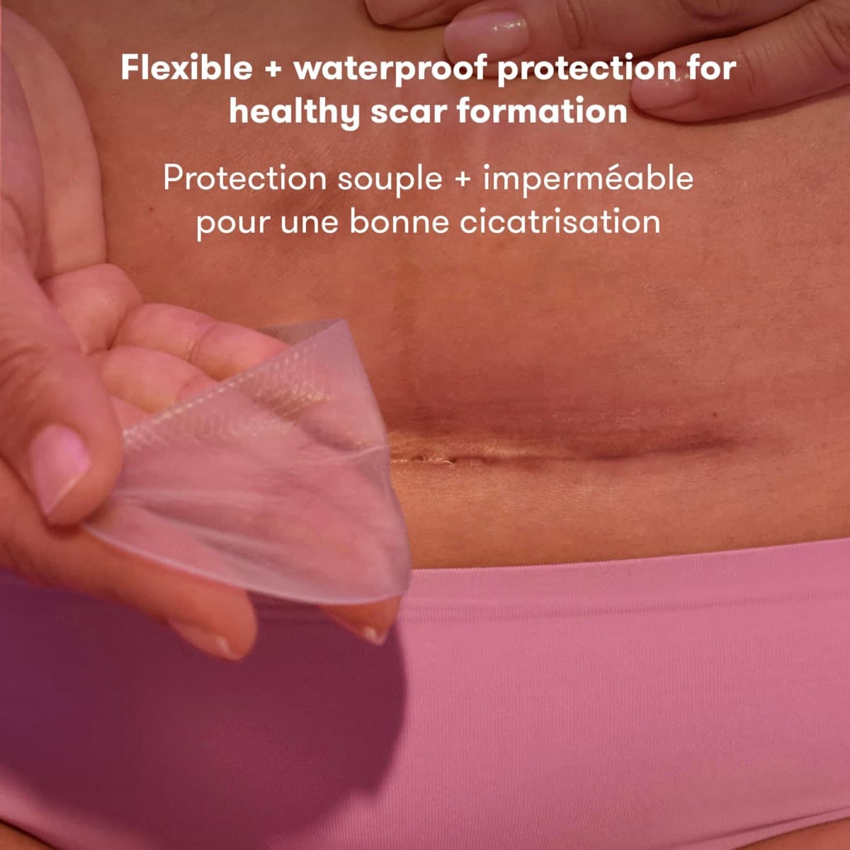 Frida Mom C-Section Silicone Strips, C-Section Recovery Must Have Scar Patches, Reusable Medical Grade Treatment for Keloid Scars, Includes Case & Pouch thumbnail 2