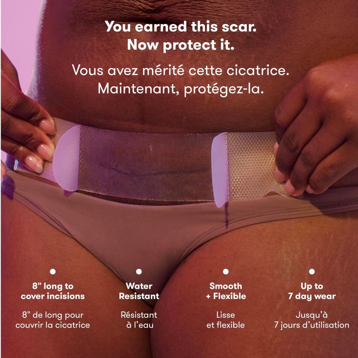 Frida Mom C-Section Silicone Strips, C-Section Recovery Must Have Scar Patches, Reusable Medical Grade Treatment for Keloid Scars, Includes Case & Pouch thumbnail 3
