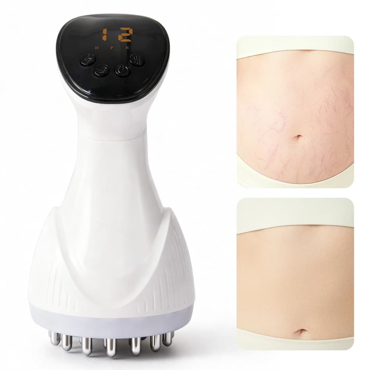 Lymphatic Drainage Massager & Anti-Cellulite Massage Tool, Body Contouring Device for Legs, Arms & Stomach, Supports Smoother Skin, with Gentle Warming & Vibration — image 1
